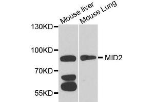 Western blot analysis of extract of mouse liver and mouse lung cells, using MID2 antibody. (Midline 2 anticorps)