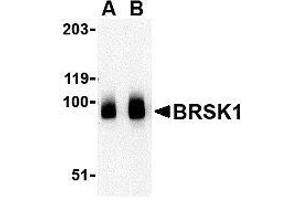 Western blot analysis of BRSK1 in human brain tissue lysate with AP30166PU-N BRSK1 antibody at (A) 0.
