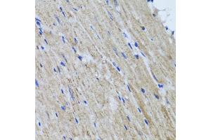 Immunohistochemistry of paraffin-embedded mouse heart using HYAL1 antibody (ABIN5975045) at dilution of 1/100 (40x lens). (HYAL1 anticorps)