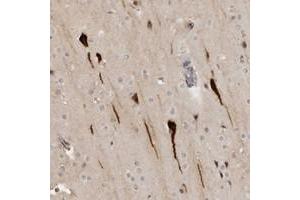 Immunohistochemical staining of human cerebral cortex with RAB11FIP3 polyclonal antibody  shows strong cytoplasmic and nuclear positivity in neuronal cells.