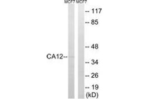 Western blot analysis of extracts from MCF-7 cells, using CA12 Antibody. (CA12 anticorps  (AA 231-280))