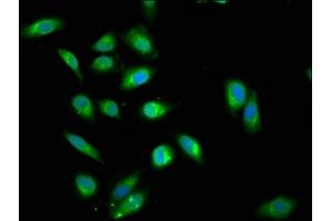 Immunofluorescence staining of Hela cells cells with ABIN7144990 at 1:200, counter-stained with DAPI. (DDX42 anticorps  (AA 519-819))