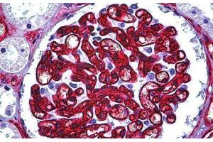 Human Kidney, Glomerulus: Formalin-Fixed, Paraffin-Embedded (FFPE) (CD34 anticorps)