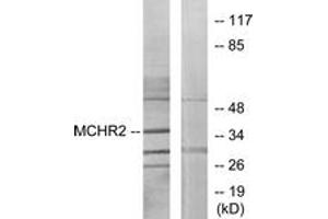 Western Blotting (WB) image for anti-Melanin-Concentrating Hormone Receptor 2 (MCHR2) (AA 291-340) antibody (ABIN2890893) (MCHR2 anticorps  (AA 291-340))
