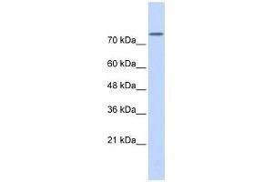 PLD2 antibody used at 5 ug/ml to detect target protein. (Phospholipase D2 anticorps  (Middle Region))