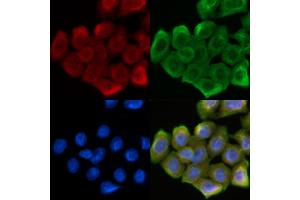 ABIN6262627 and ABIN6268688 staining Hela cells(30 min of UV treatment) by IF/ICC.