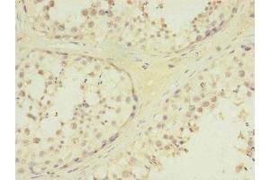 Immunohistochemistry of paraffin-embedded human testis tissue using ABIN7172730 at dilution of 1:100 (MTERFD3 anticorps  (AA 1-250))