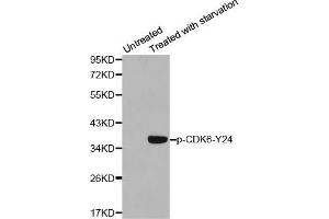 Western blot analysis of extracts from 293 cells using Phospho-CDK6-Y24 antibody (ABIN2987839). (CDK6 anticorps  (pTyr24))