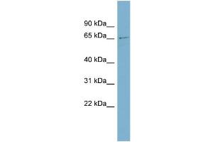 WB Suggested Anti-ZNF18 Antibody Titration:  0. (ZNF18 anticorps  (Middle Region))