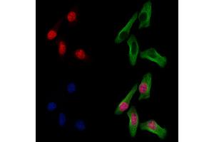ABIN7094711 and ABIN7098762 staining Hela cells by IF/ICC. (Histone H1.5 anticorps  (N-Term))