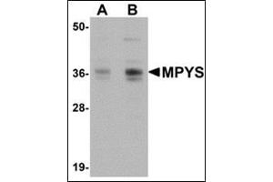 Western blot analysis of MPYS in A-20 cell lysate with AP30565PU-N MPYS antibody at 1 µg/ml (A) and 2 μg/ml (B). (STING/TMEM173 anticorps  (C-Term))