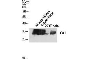 Western Blot (WB) analysis of Mouse Kidney Mouse Brain 293T HeLa lysis using CA II antibody. (CA2 anticorps  (C-Term))