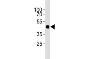 Western blot analysis of lysate from 12 tagged recombinant protein cell lines using HA antibody diluted at 1:1000. (HA-Tag anticorps)