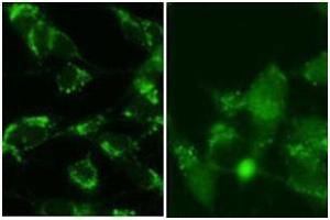SY5Y cells were pretreated with 5nM bafilomycin for 24hr and fixed in methanol (left panel) or 4% of paraformaldehyde (right panel).