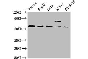 Western Blot Positive WB detected in: Jurkat whole cell lysate, HepG2 whole cell lysate, Hela whole cell lysate, MCF-7 whole cell lysate, SH-SY5Y whole cell lysate All lanes: SLC37A2 antibody at 1:2000 Secondary Goat polyclonal to rabbit IgG at 1/50000 dilution Predicted band size: 55, 43, 14 kDa Observed band size: 55 kDa