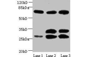 Western blot All lanes: Amyloid beta A4 antibody at 1 μg/mL Lane 1: Mouse heart tissue Lane 2: Mouse kidney tissue Lane 3: Mouse lung tissue Secondary Goat polyclonal to Mouse IgG at 1/15000 dilution Predicted band size: 30, 35, 72, 80 kDa Observed band size: 30, 35, 72 kDa (APP anticorps)