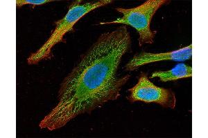 Indirect immunostaining of HELA cells with anti-syntaxin 18 (dilution 1 : 100; green) and anti-α-tubulin (cat. (Syntaxin 18 anticorps  (AA 55-313))