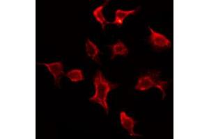 ABIN6273842 staining Hela by IF/ICC. (CMKLR1 anticorps  (Internal Region))