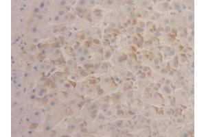 DAB staining on IHC-P; Samples: Human Liver Tissue (IFNA4 anticorps  (AA 10-163))