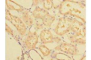 Immunohistochemistry of paraffin-embedded human kidney tissue using ABIN7148068 at dilution of 1:100 (CCDC112 anticorps  (AA 201-446))
