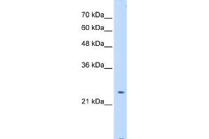 WB Suggested Anti-PTPN2 Antibody Titration:  0.