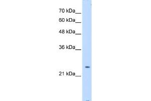 WB Suggested Anti-PTPN2 Antibody Titration:  0. (PTPN2 anticorps  (Middle Region))