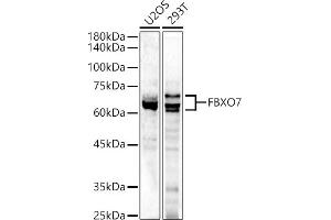 Western blot analysis of extracts of various cell lines, using FBXO7 antibody (ABIN6130383, ABIN6140527, ABIN6140528 and ABIN6223349) at 1:500 dilution. (FBXO7 anticorps  (AA 353-522))