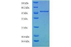 SDS-PAGE (SDS) image for Solute Carrier Family 25, Member 30 (SLC25A30) (AA 1-291), (full length) protein (His-SUMO Tag) (ABIN5711415)