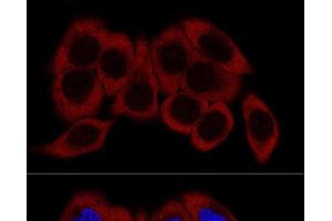 Confocal immunofluorescence analysis of HeLa cells using RPL23 Polyclonal Antibody at dilution of 1:200.