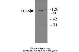 Image no. 1 for anti-Amyloid beta (A4) Precursor Protein-Binding, Family B, Member 1 (Fe65) (APBB1) antibody (ABIN363592) (FE65 anticorps)