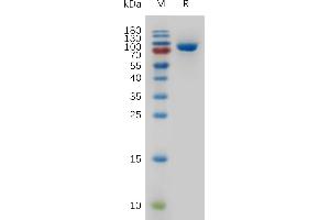 Human TFRC Protein, His Tag on SDS-PAGE under reducing condition.