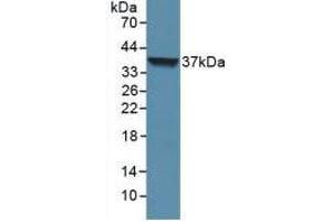 Western blot analysis of recombinant Human LOR. (LOR anticorps  (AA 210-295))