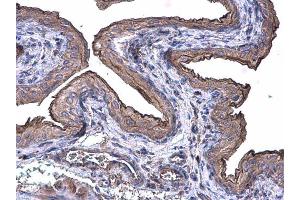IHC-P Image Cytokeratin 20 antibody [N2C2], Internal detects Cytokeratin 20 protein at cytoplasm on mouse urinary bladder by immunohistochemical analysis. (KRT20 anticorps)