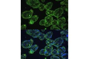 anti-Keratin 13 (KRT13) (AA 269-458) antibody