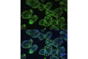 Immunofluorescence analysis of human placenta using Cytokeratin 13 (Cytokeratin 13 (KRT13)) Polyclonal Antibody (ABIN7268090) at dilution of 1:100 (40x lens). (Cytokeratin 13 anticorps  (AA 269-458))