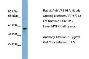 WB Suggested Anti-VPS16  Antibody Titration: 0. (VPS16 anticorps  (N-Term))