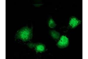 Immunofluorescence (IF) image for anti-Microtubule-Associated Protein, RP/EB Family, Member 2 (MAPRE2) antibody (ABIN1499317) (MAPRE2 anticorps)