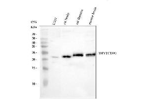 Western blot analysis of CD90/Thy1 using anti-CD90/Thy1 antibody (ABIN7600517).