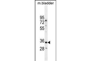 Western blot analysis in mouse bladder tissue lysates (35ug/lane). (C17orf59 anticorps  (AA 186-215))