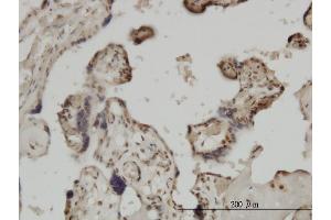 Immunoperoxidase of monoclonal antibody to ZIC4 on formalin-fixed paraffin-embedded human placenta. (ZIC4 anticorps  (AA 249-319))
