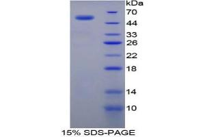 SDS-PAGE analysis of Rat TGM1 Protein.