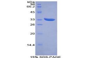 SDS-PAGE analysis of Mouse PINK1 Protein. (PINK1 Protéine)