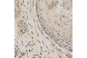 Immunohistochemistry (IHC) image for anti-serpin Peptidase Inhibitor, Clade F (Alpha-2 Antiplasmin, Pigment Epithelium Derived Factor), Member 1 (SERPINF1) (AA 1-200) antibody (ABIN3022373)