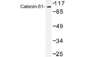 Image no. 1 for anti-Catenin (Cadherin-Associated Protein), delta 1 (CTNND1) antibody (ABIN317789) (CTNND1 anticorps)