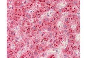 Anti-Beta Galactosidase antibody IHC staining of human liver.