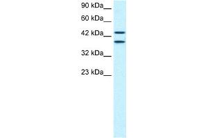 WB Suggested Anti-C14ORF131 Antibody Titration:  0. (ZNF839 anticorps  (Middle Region))