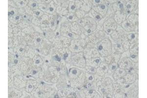Detection of ROR2 in Human Liver Tissue using Polyclonal Antibody to Receptor Tyrosine Kinase Like Orphan Receptor 2 (ROR2) (ROR2 anticorps  (AA 683-934))