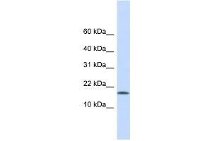 CENPA antibody used at 1 ug/ml to detect target protein. (CENPA anticorps  (Middle Region))