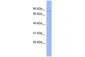 WB Suggested Anti-CNOT3 Antibody Titration:  0. (CNOT3 anticorps  (C-Term))