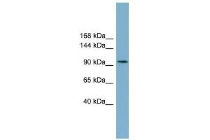 SLC12A3 antibody used at 1 ug/ml to detect target protein. (SLC12A3 anticorps)